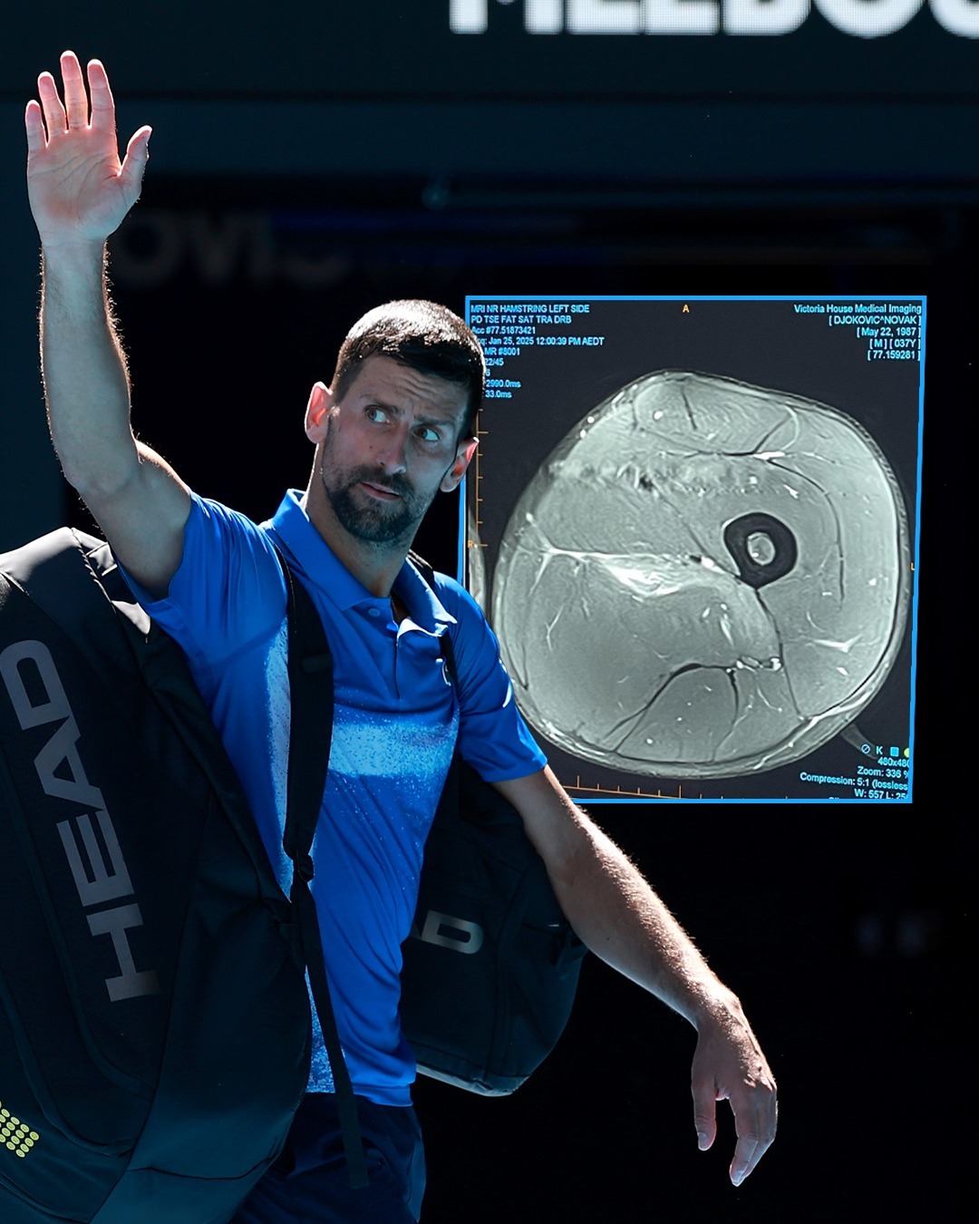  德约科维奇新星出色防守表现惊艳，瑞士队未来可期！